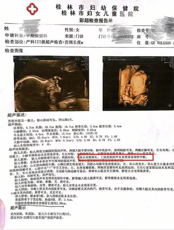 桂林女子称彩超漏诊婴儿唇裂,到卫健委反映问题竟遭怒斥,涉事医院