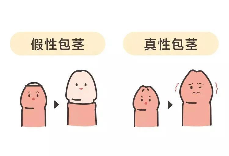 男宝宝私处说明书:包皮,蛋蛋,小 jj,这些问题必须得知道