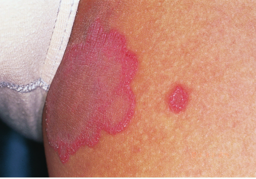 屁股上摸到的小凸起,到底是啥啊?