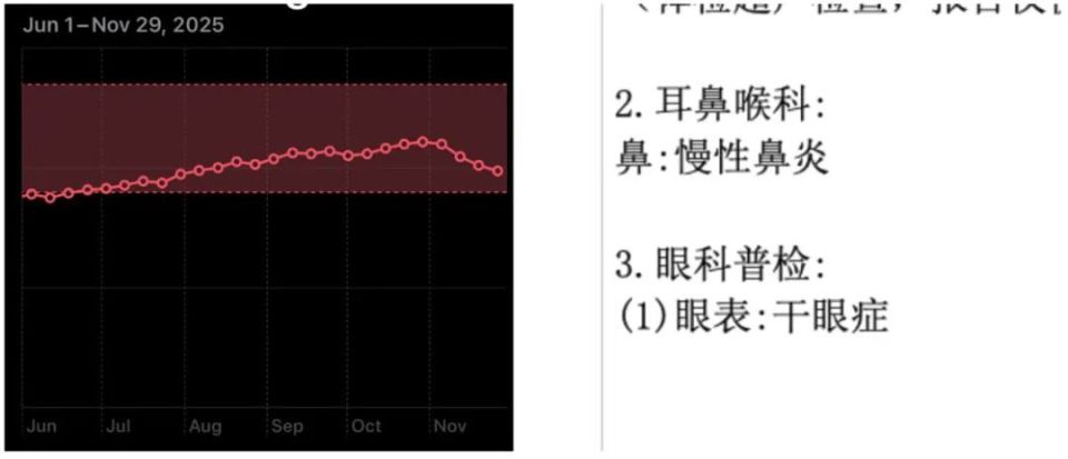 海水鼻腔喷雾器怎么用我们最近又买了 5 个好用的「新玩意」_https://www.jmylbn.com_新闻资讯_第12张