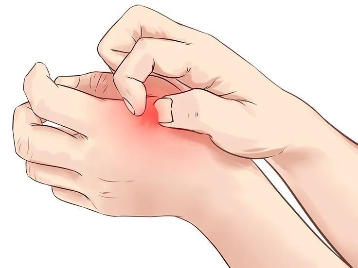 被蚊子咬了,管住手!