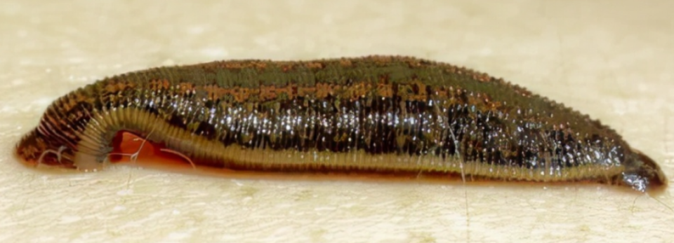 【健康宾川】吸血虫,血吸虫,您要仔细分清楚!