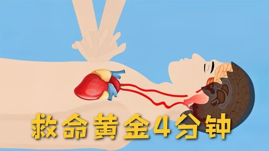 中国心肺复苏周202367心肺复苏急救要领关键时刻能救命