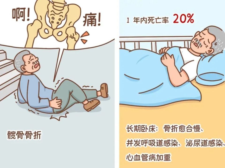 骨折愈合过程动画图片