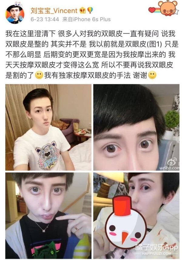 好久不见网红刘梓晨啦，终于不是锥子脸了？_腾讯新闻