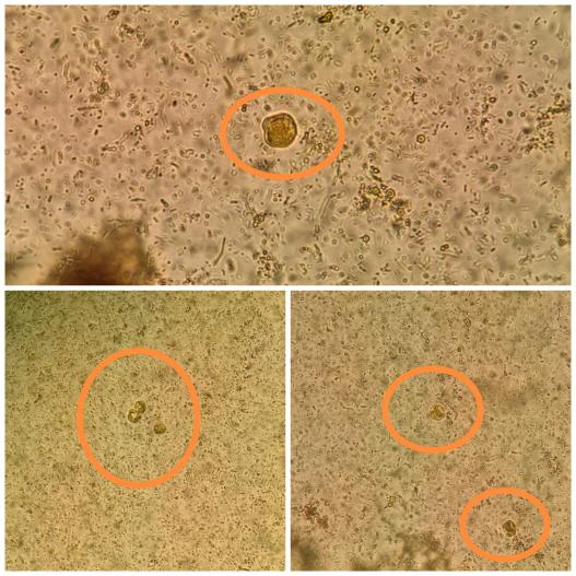 人芽囊原虫感染,你知多少?