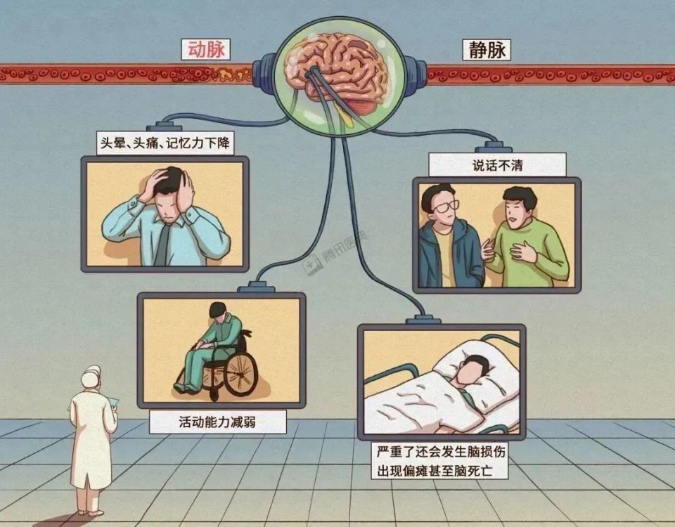 出现这6个症状,警惕血管堵塞!