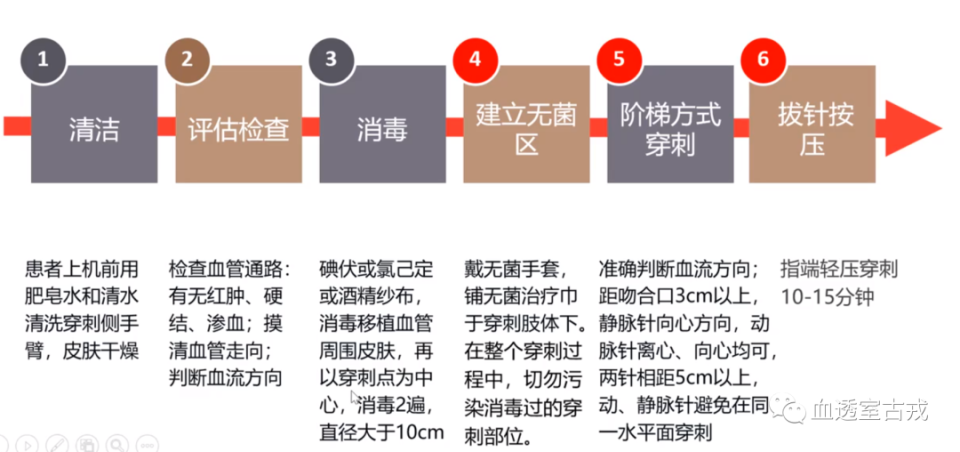 透析三种穿刺方法图片图片