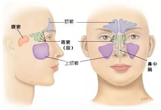 什么叫副鼻窦炎 腾讯网