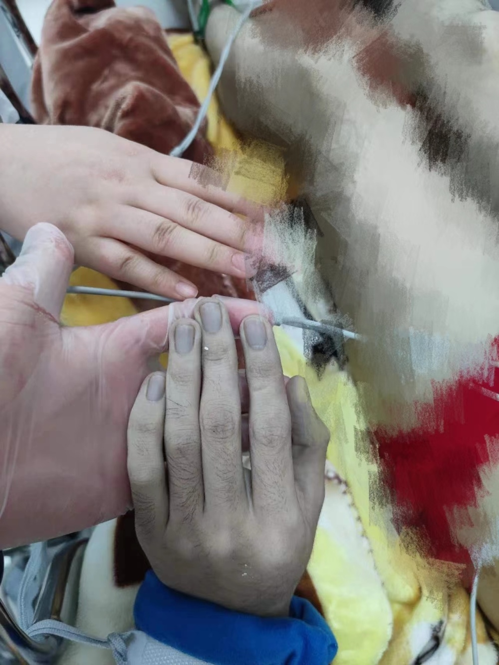 男子亚硝酸盐中毒险送命,医生15分钟确认毒物成功救回_腾讯新闻