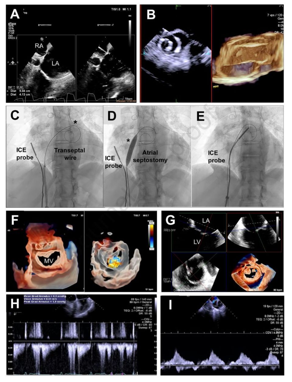 3D ICE辅助结构心-腾讯新闻