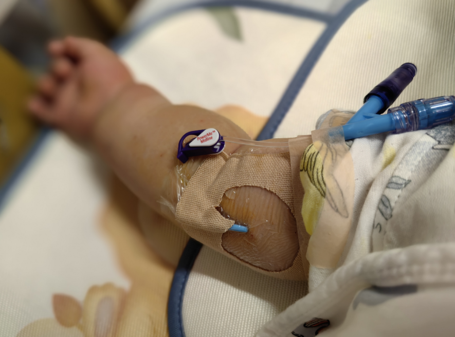 福建首例!让这类患者输液告别"扎!扎!扎!