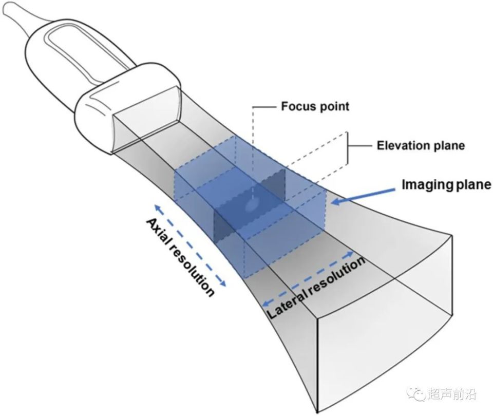 ge医疗器械怎么样GE vs 飞利浦 vs Butterfly ： 手持超声参数差异对比_https://www.jmylbn.com_新闻资讯_第2张