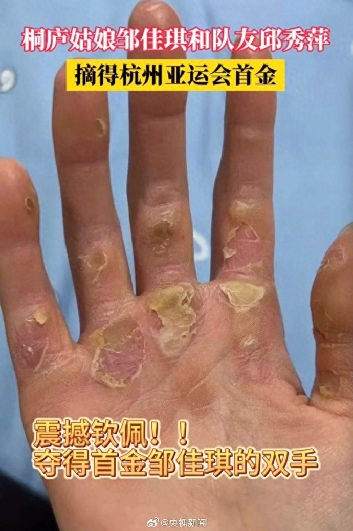 亚运会首金姑娘邹佳琪的双手布满老茧和血泡,爸爸心疼女儿:看到就心痛