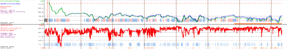 呼吸机怎么打开Ⅱ型呼吸衰竭又陷诊断困局……当室速撞上呼吸“牢笼”，如何通过破解隐匿的神经肌肉密码打开思路，拨云见日？丨疑案探密（161）_https://www.jmylbn.com_新闻资讯_第4张