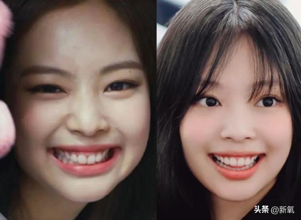 宁可面相变刻薄也要改这里,只有我为jennie感到不值吗?_腾讯新闻