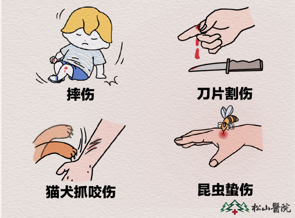 摔伤刀片割伤要留意松山医院部分伤口需注射破伤风进行预防
