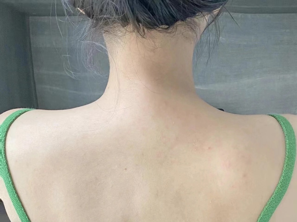 过来人三个建议!粗糙皮肤也能恢复光滑细嫩!_腾讯新闻