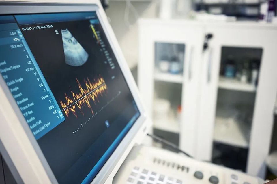 汕头彩超怎么样“国产超声鼻祖”IPO上岸，前景却难见光明_https://www.jmylbn.com_新闻资讯_第1张