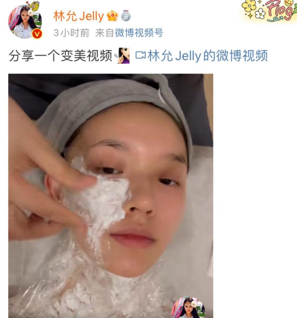 27岁林允大方分享医美过程脖子上都不放过隔着屏幕都感觉到疼