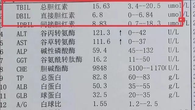 胆红素升高,3大解决办法!