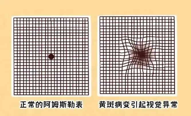 可能不是"老花眼"哦