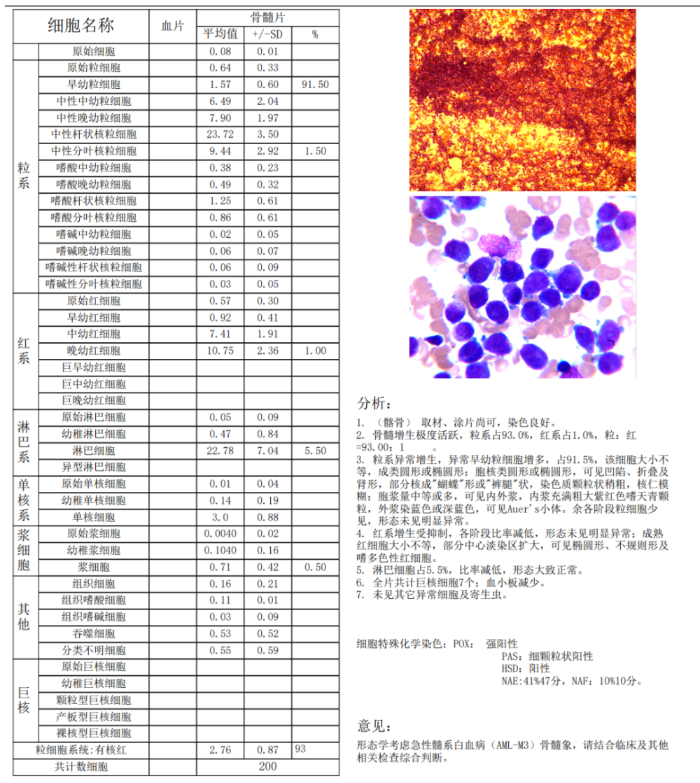 基因檢查結果該患者骨髓細胞形態學示急性早幼粒細胞白血病,基因結果