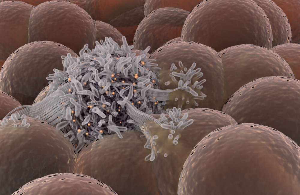 乳腺cr是什么CR：乳腺癌细胞，太会装了！科学家发现，乳腺癌细胞会表达免疫标志物模拟免疫细胞，增强增殖与生存能力_https://www.jmylbn.com_新闻资讯_第3张