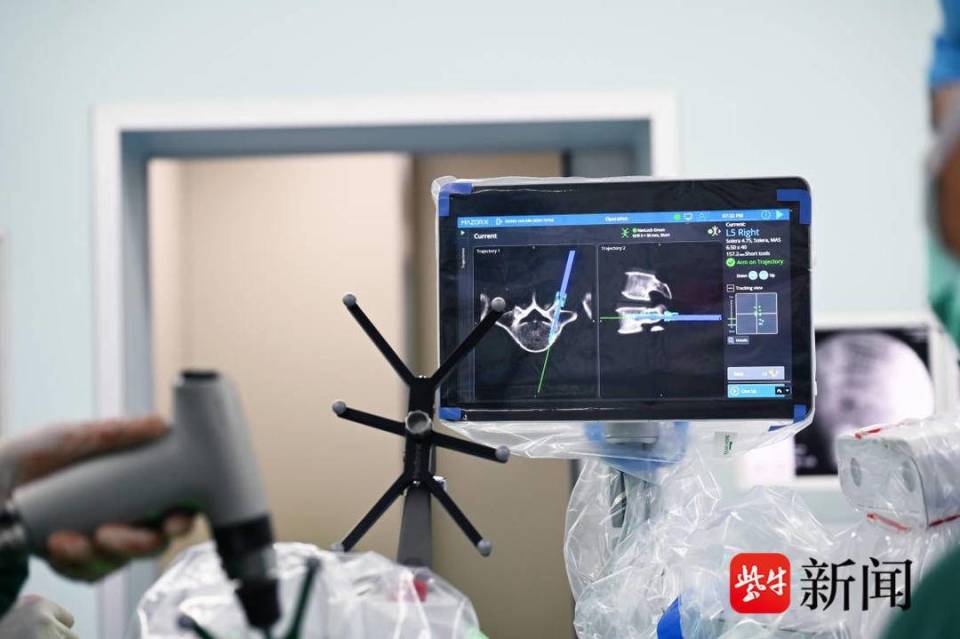 镇江瑞康医院数智骨科首秀成功开展该市首例脊柱机器人手术