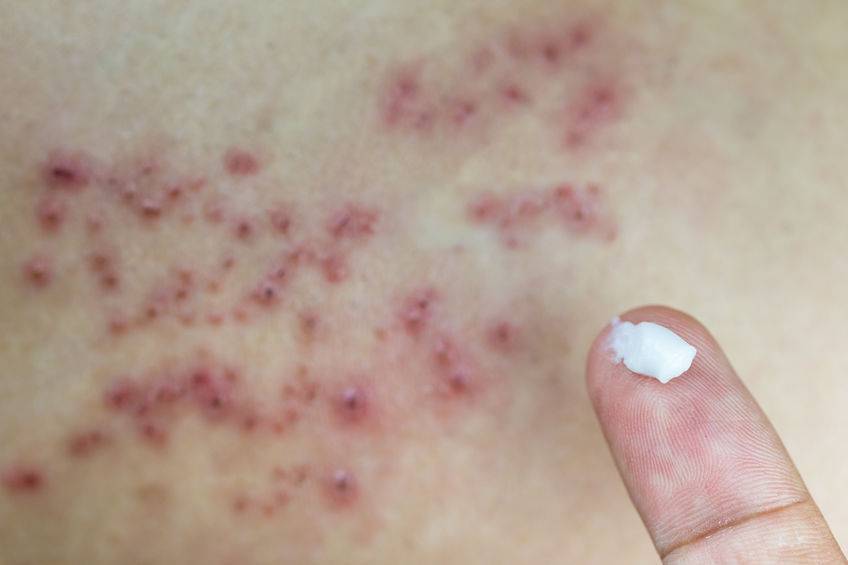 有种剧痛叫"带状疱疹"!究竟如何治疗能较快缓解疼痛?一文科普