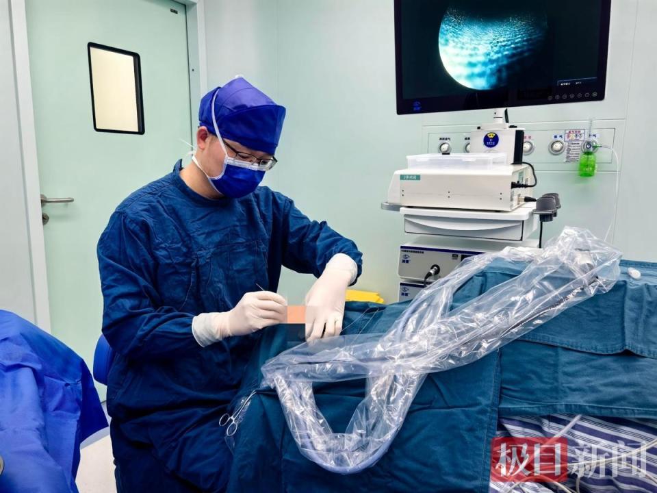 硅胶引流球怎么放置硅胶管残留泪道9个月，医生为老人取出_https://www.jmylbn.com_新闻资讯_第1张