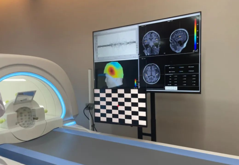 我国脑机接口技术处于全球第一梯队