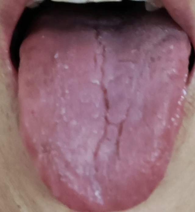 嘴巴干得像砂纸？口干可能藏大问题，你知道