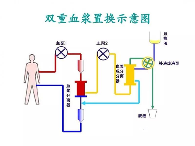 血液净化示意图图片