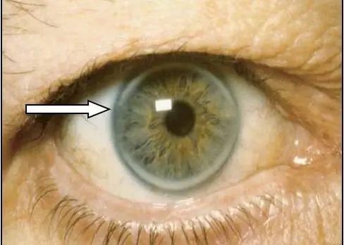 EV是什么针第一批90后已经高血脂！打一针管半年的降脂新方法来啦_https://www.jmylbn.com_新闻资讯_第2张