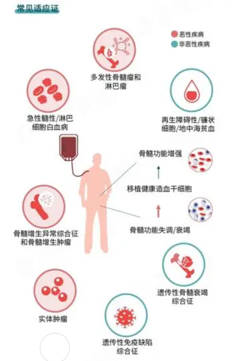 干细胞回输技术：再生医学未来发展的新引擎