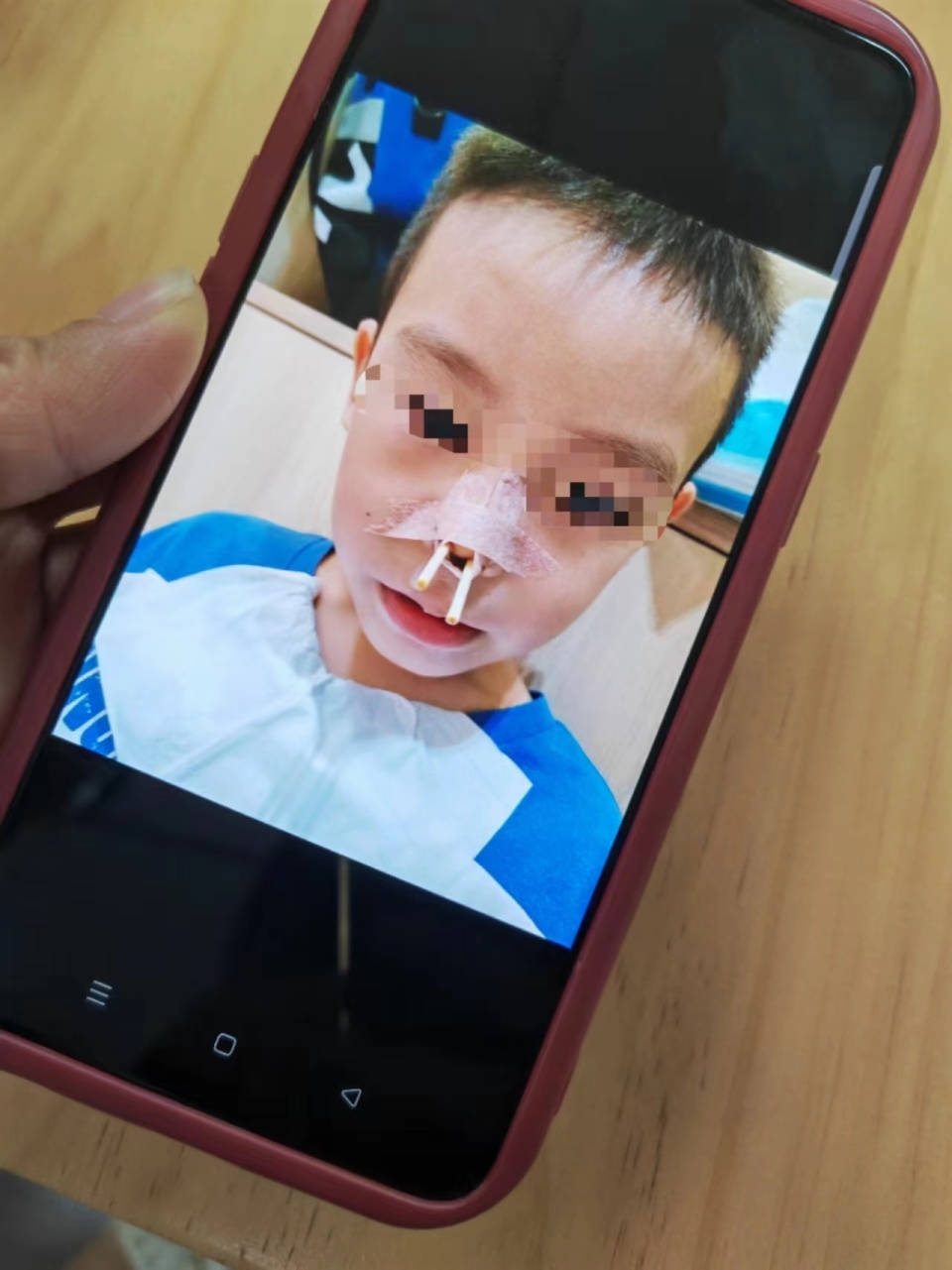 长沙22名孩子被"消鼻甲"治鼻炎:有人鼻腔糜烂,"神医"无行医资格