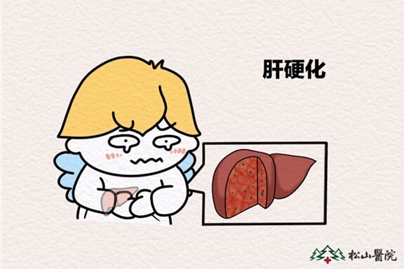 松山医院有这些肝硬化早期信号要尽快就医检查