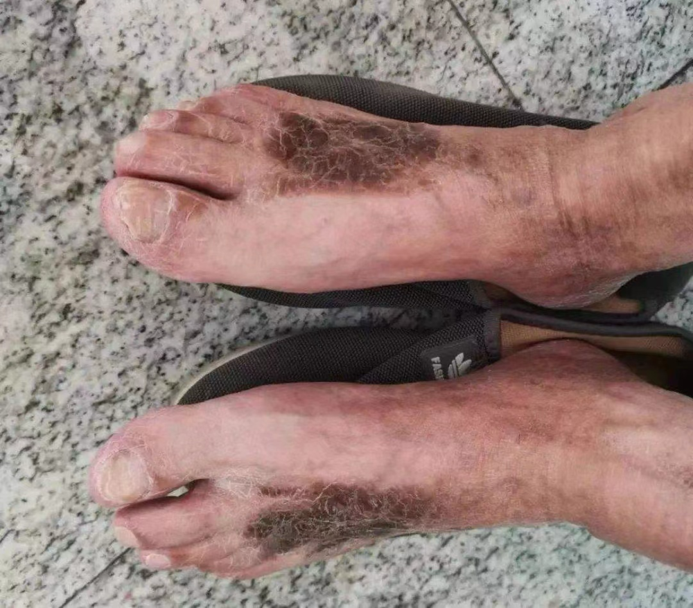 警惕冬季泡脚惹出的病!医生:泡脚有讲究,泡不对会伤身_腾讯新闻