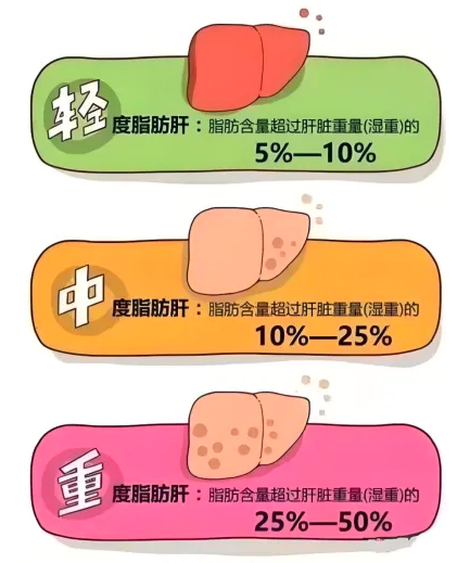 有人减肥减掉了脂肪肝,有人减肥出现了脂肪肝 如何及时发现脂肪肝?
