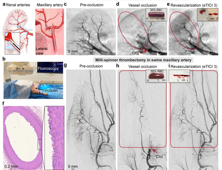 血凝哪些机器比较好专访赵芮可：用微型血栓机器人显著缩小血栓体积，或成脑梗心梗治疗新突破_https://www.jmylbn.com_新闻资讯_第8张
