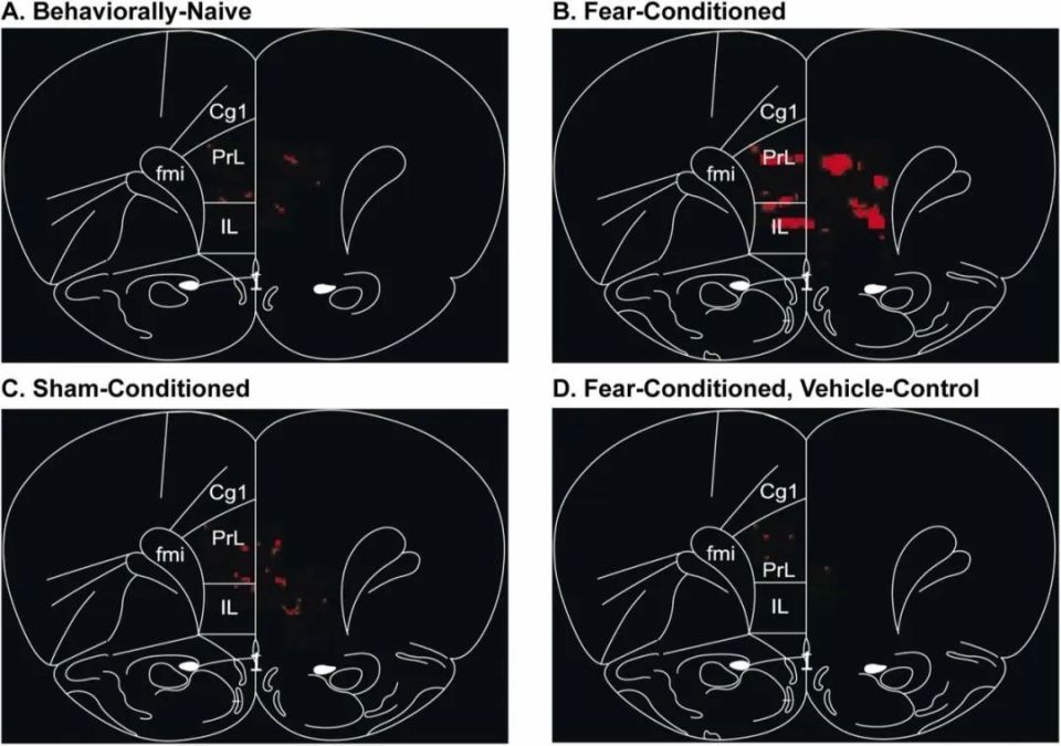 以色列医疗设备有哪些追问weekly ｜ 过去一周，脑科学领域有哪些新发现？Vol.63_https://www.jmylbn.com_新闻资讯_第8张