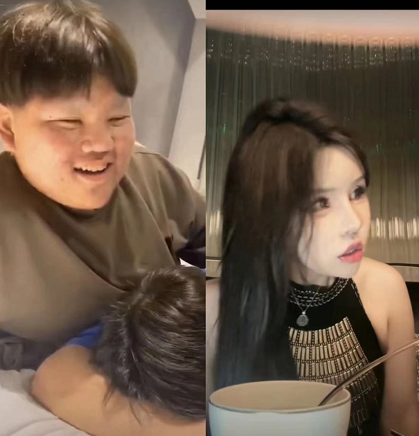 整容后遗症可谓是大费周章虽然她现在确实是变漂亮了看起来也确实是像