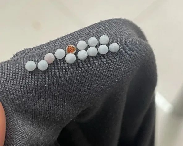 身上痒一挠就起红点图__身上痒一挠就红一片
