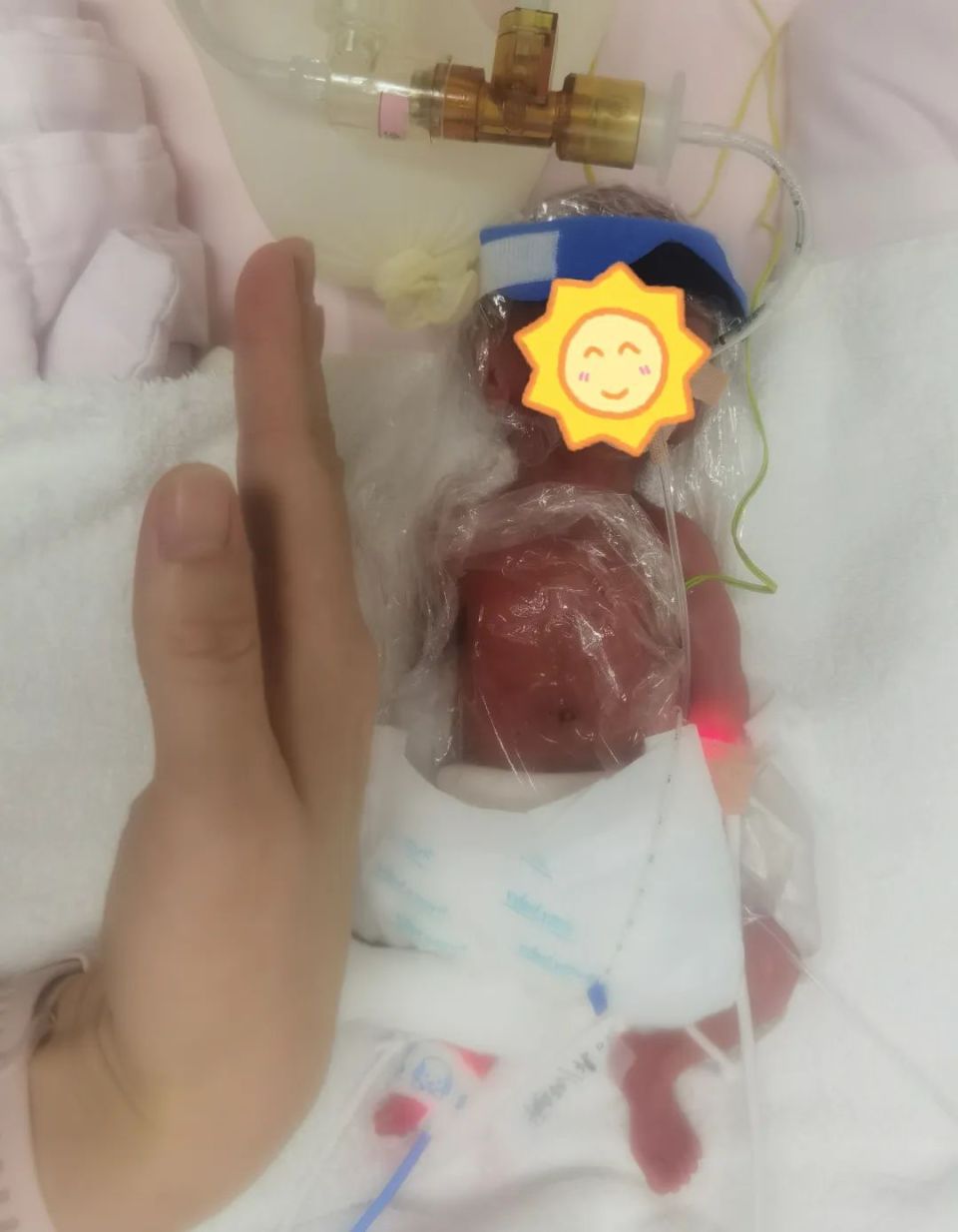 再创生命奇迹,青岛妇儿医院一名超低体重早产儿回家啦