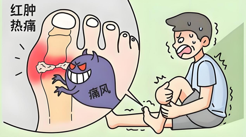 痛风开始年轻化?多注意这几点!