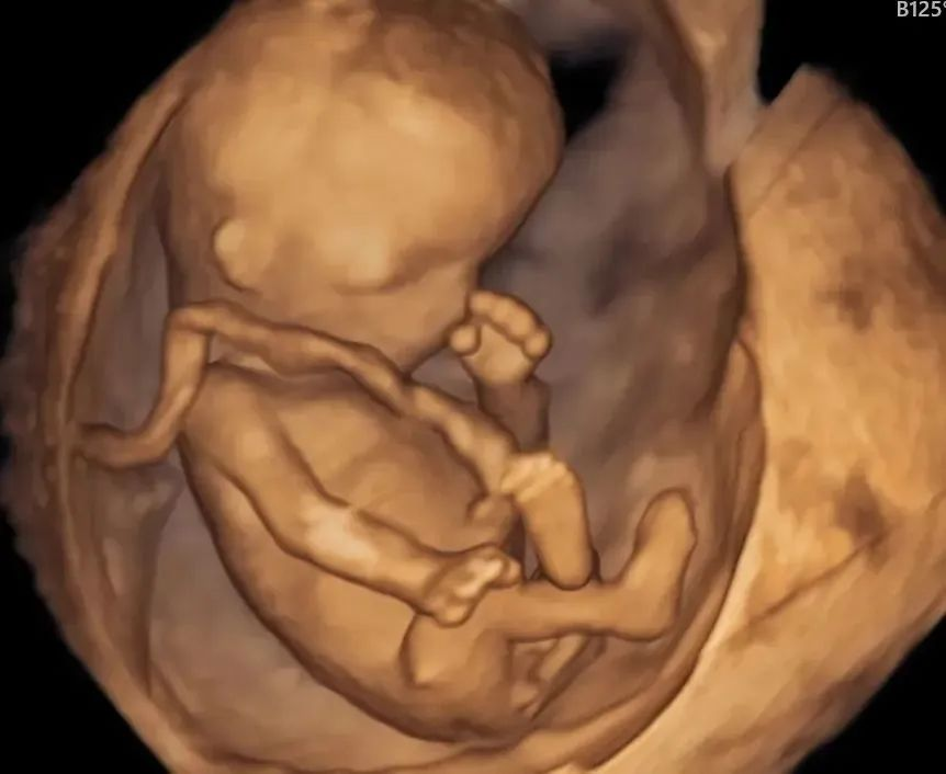 胎儿四维彩超真实图片