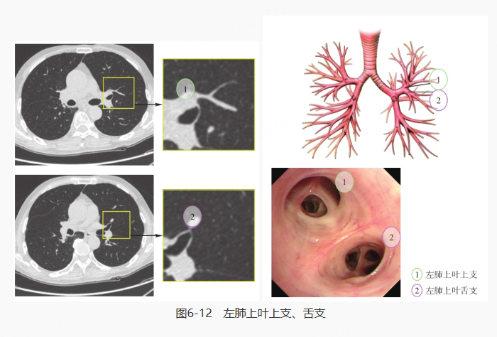 左肺上叶·下叶,左肺上叶上支·舌支,左肺上叶尖后段·前段,左肺上叶