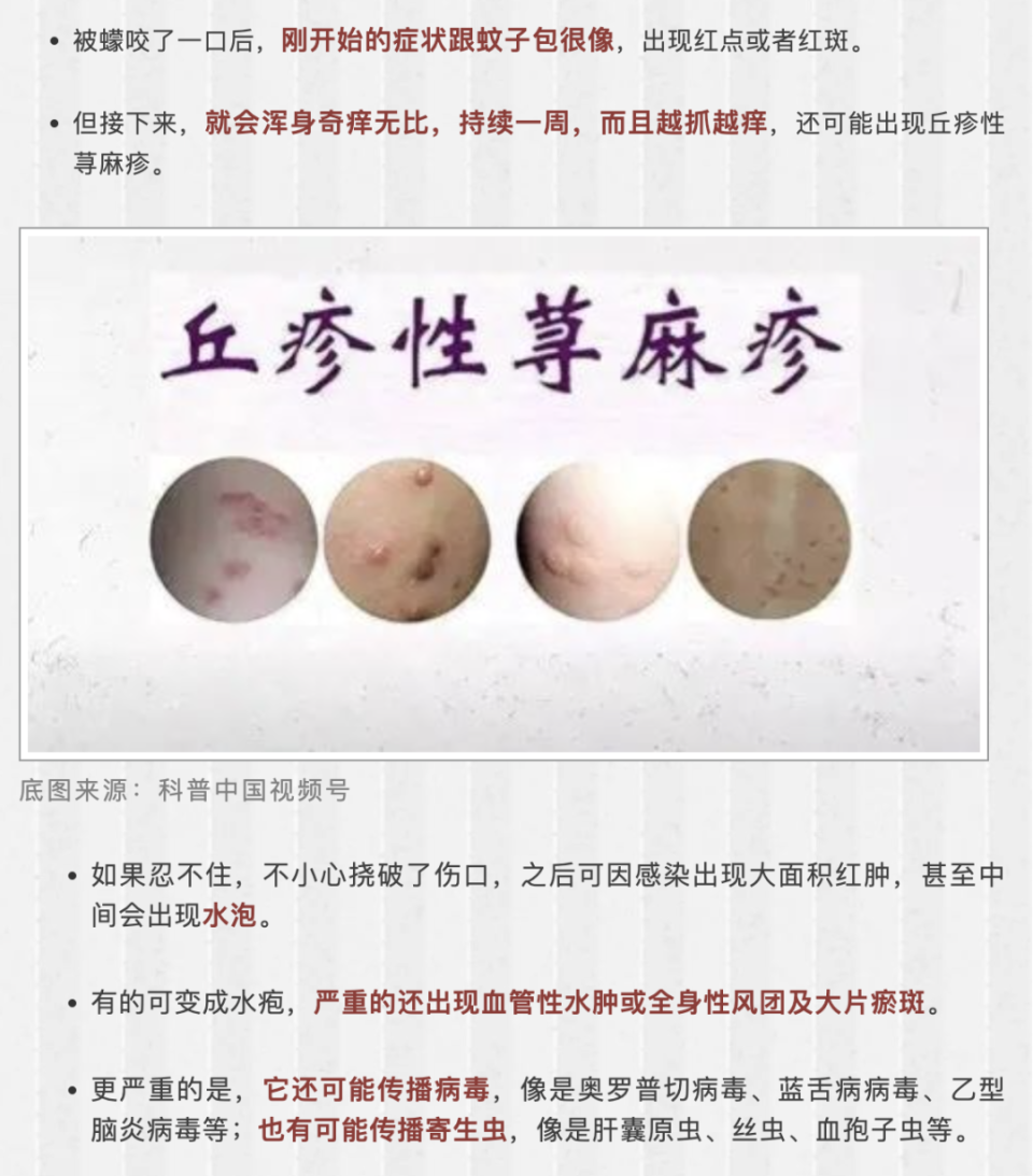 裸露在外的四肢,腰腹部是最常见的好发部位,症状表现反复,有时呈慢性