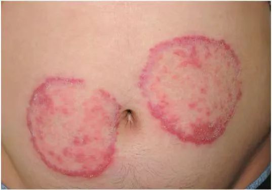 屁股上摸到的小凸起,到底是啥啊?